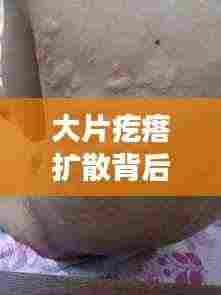 大片疙瘩扩散背后的皮肤真相揭秘